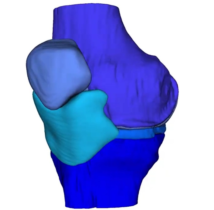Content View